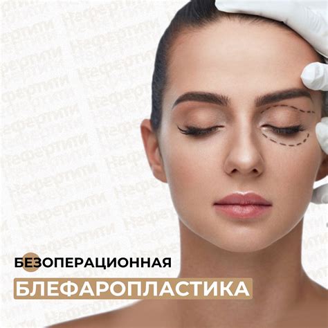 blefaroplastika-v-habarovske-2