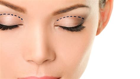 blefaroplastika-v-nizhnem-novgorode-2