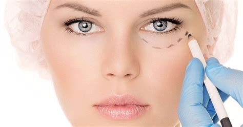 blefaroplastika-v-nizhnem-tagile-2