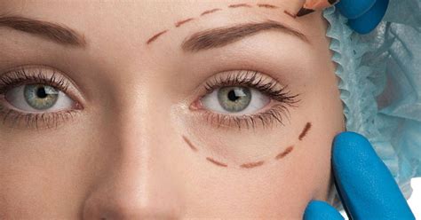 blefaroplastika-v-novosibirske-2