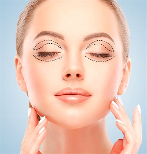 blefaroplastika-vo-vladimire-2