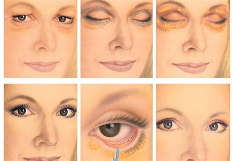 gryzha-vek-nizhnego-verhnego-foto