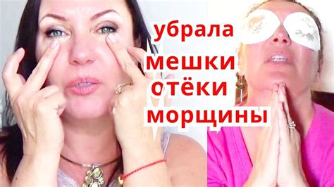 kak-ubrat-meshki-pod-glazami-narodnymi-sredstvami-bystro-sposoby-foto