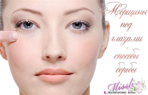 kak-ubrat-morschiny-pod-glazami-v-domashnih-usloviyah-u-zhenschin-prichiny