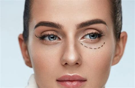 chto-takoe-besshovnaya-blefaroplastika