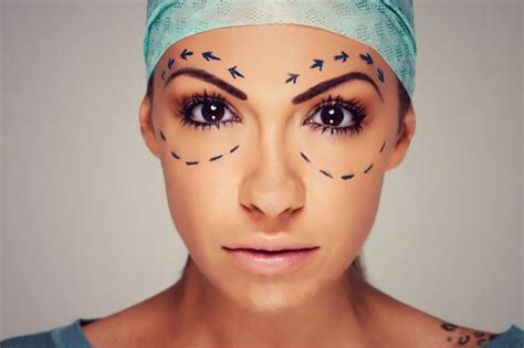 bezoperatsionnaya-pulsar-blefaroplastika-kak-vypolnyaetsya