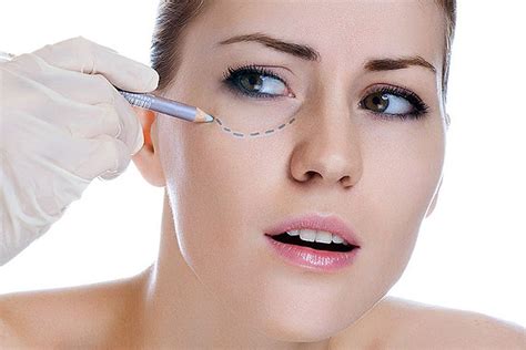 gde-luchshe-delayut-blefaroplastiku