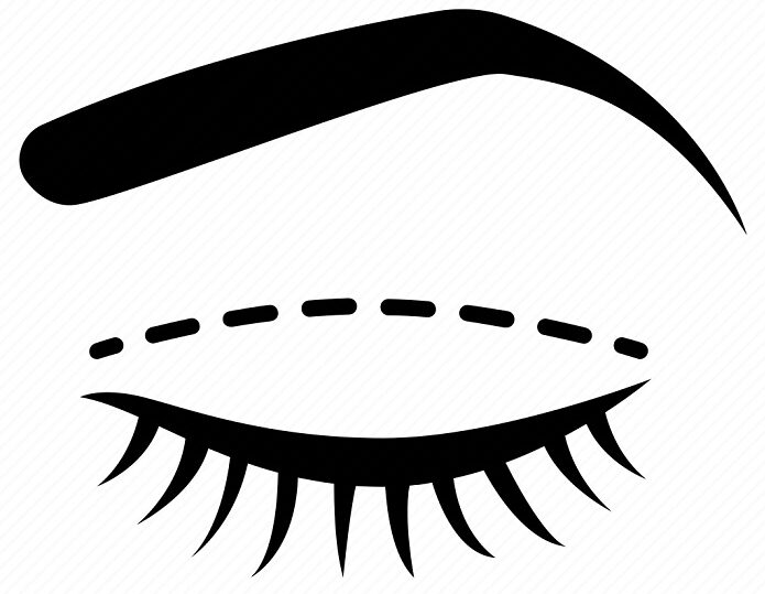 Блефаропластика век | Отзывы | Цена | Фото до и после